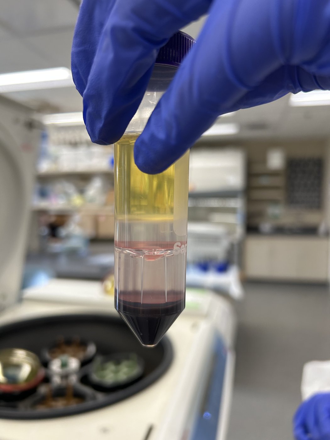 A blood sample separated into layers in a centrifuge tube